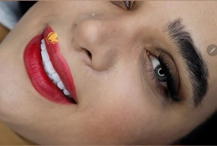 دکتر زهرا صوفی نژاد کامپوزیت ونییر,لمینت سرامیکی,اندو,پروتز جراح دندانپزشک در تهران