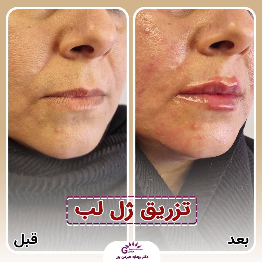  دکتر رودابه هیرمن پور 